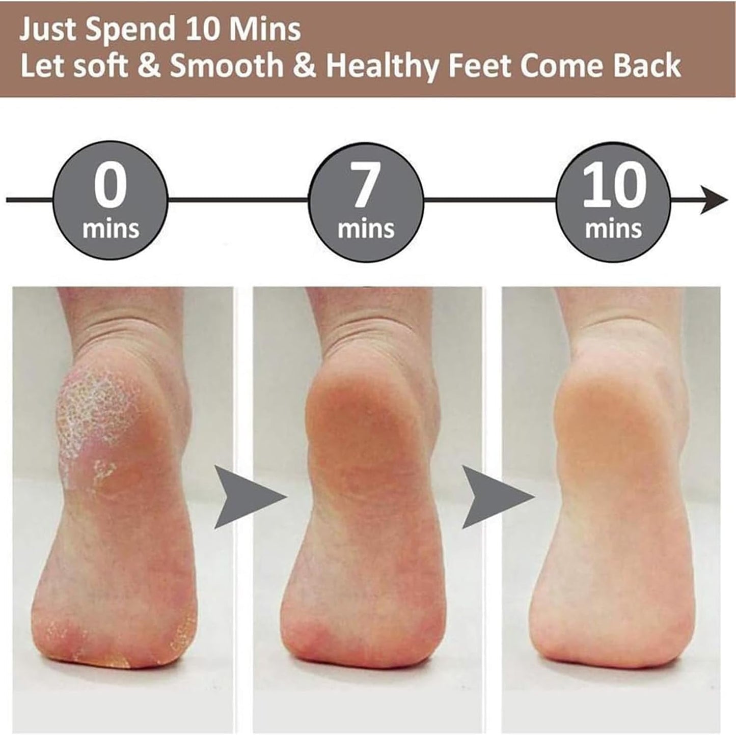 electric feet callus remover, electric foot file, callus remover, portable electronic rechargeable pedicure kit tools, for dead, hard cracked dry skin (white 1pc)
