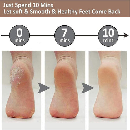 Electric Feet Callus Remover, Electric Foot File, Callus Remover, Portable Electronic Rechargeable Pedicure Kit Tools, for Dead, Hard Cracked Dry Skin (White 1PC)